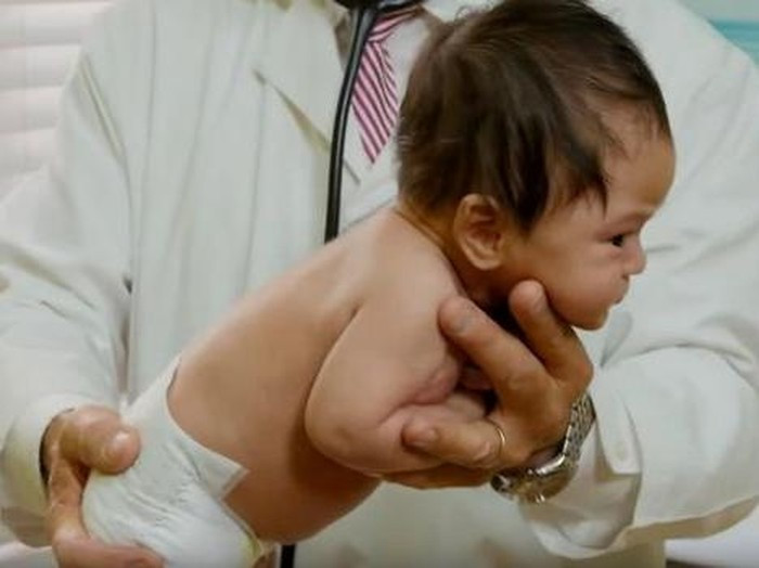 Gangguan Tumbuh Kembang Anak