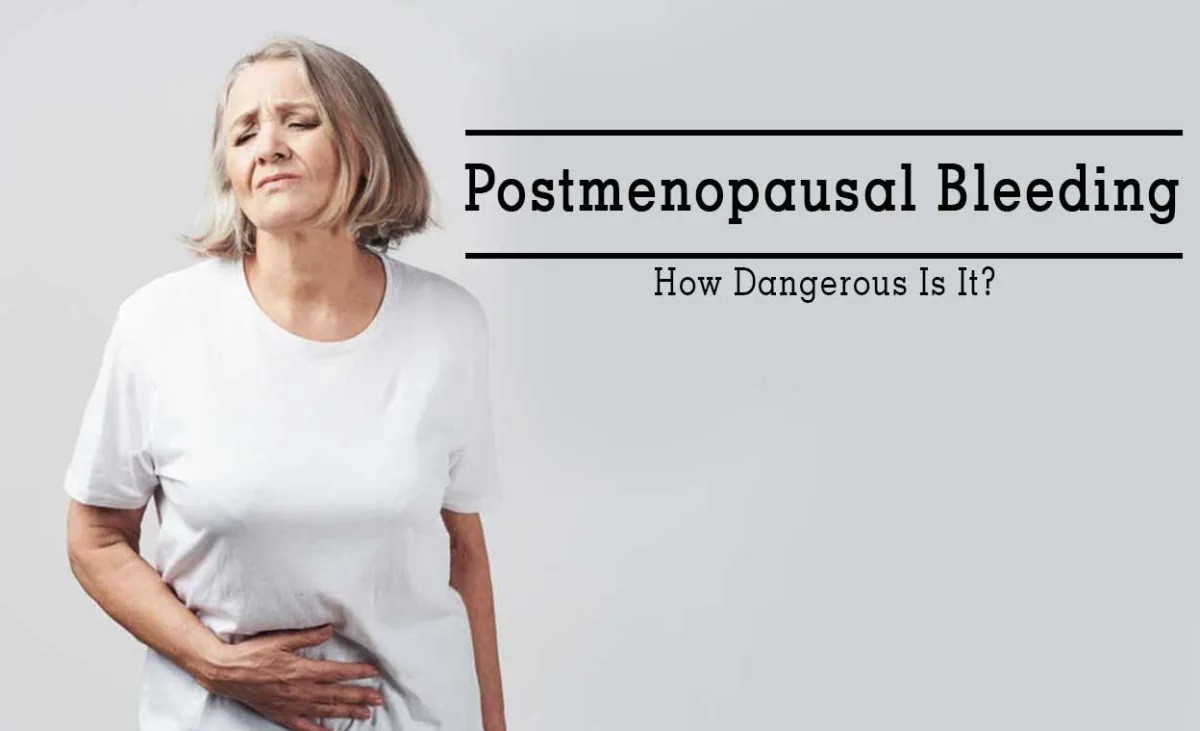 Perdarahan Pasca-Menopause