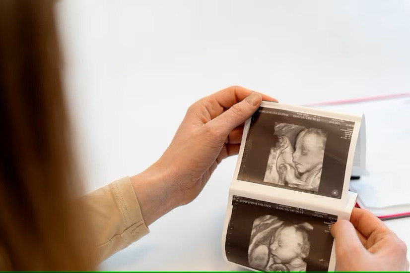 Mengurangi Risiko Bayi Lahir Mati (Stillbirth)