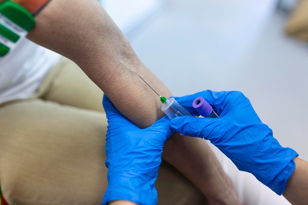 Tips for Maintaining Healthy Blood Vessels