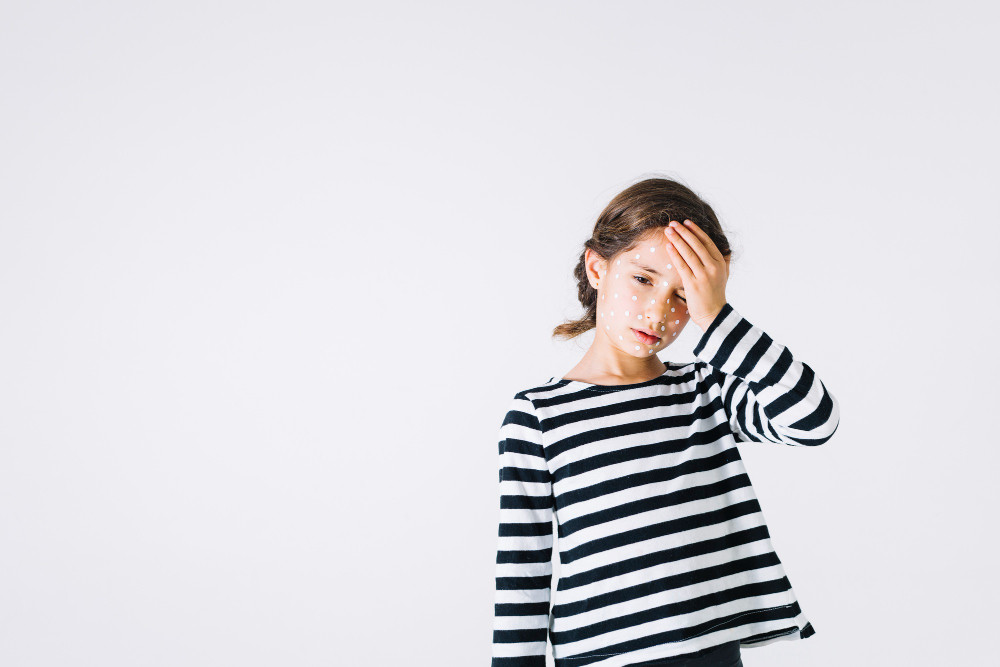 Kenali Gejala Flu Tomat dan Cara Pencegahannnya