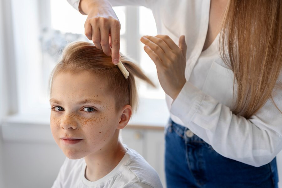 Penyebab Munculnya Nevus Sebaceous, Tanda Lahir di Kulit Kepala